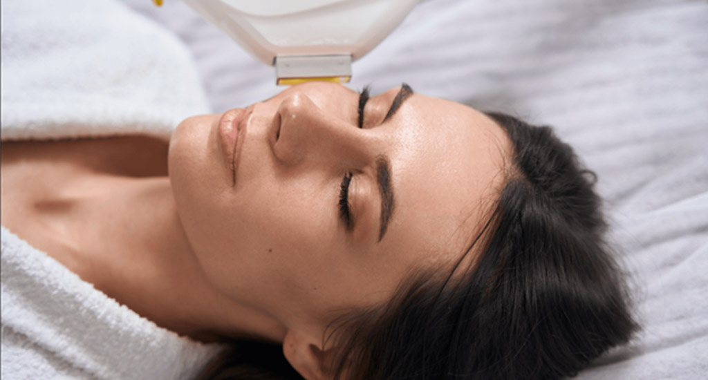 woman receiving laser treatment on her face